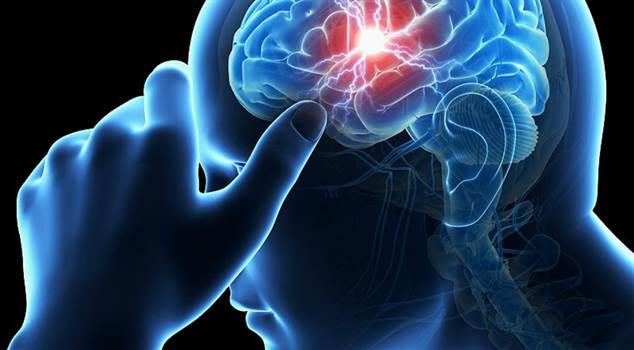 Acidente Vascular Cerebral: o que é, causas e como prevenir